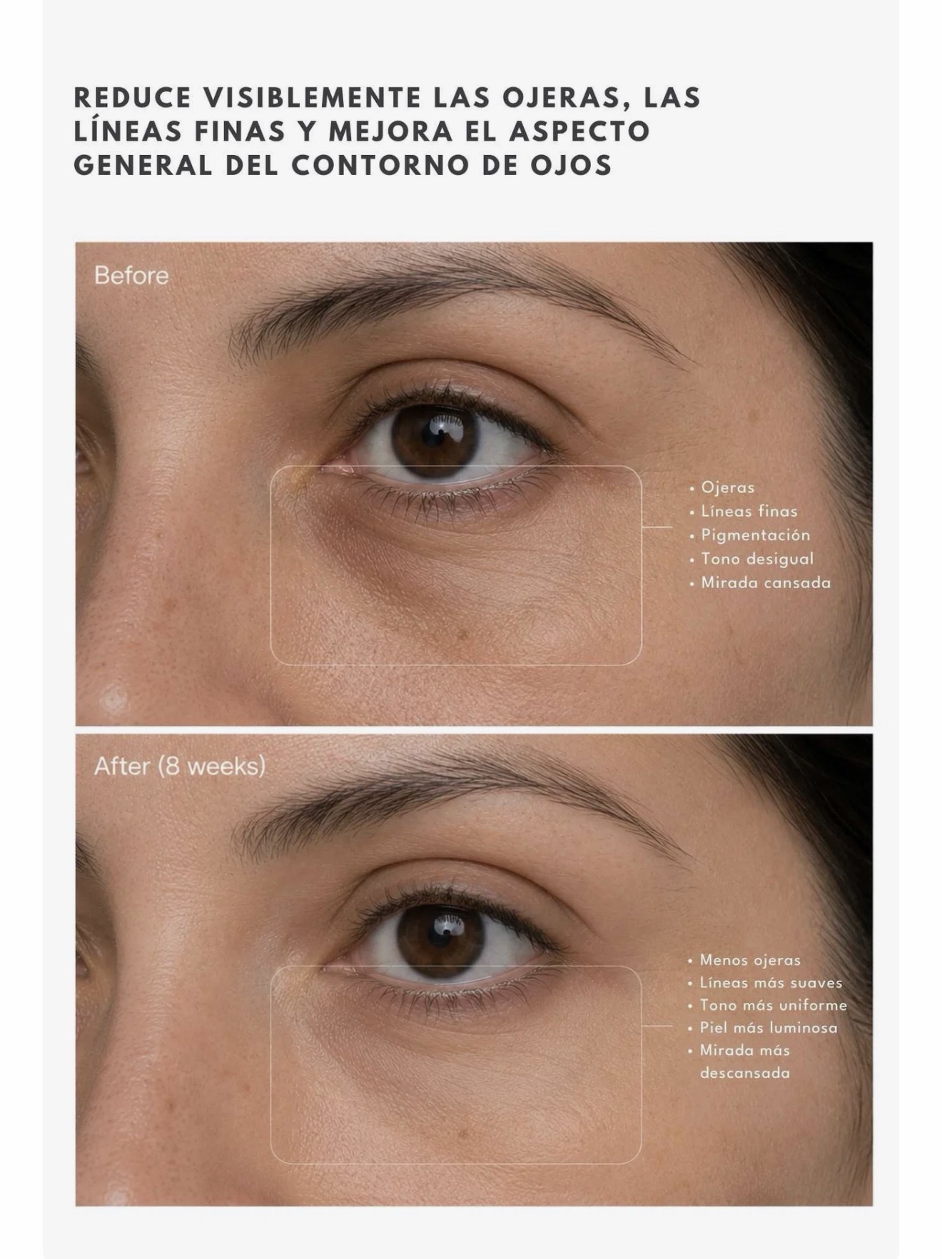 Contorno de ojos de Retinaldehído - Imagen 2