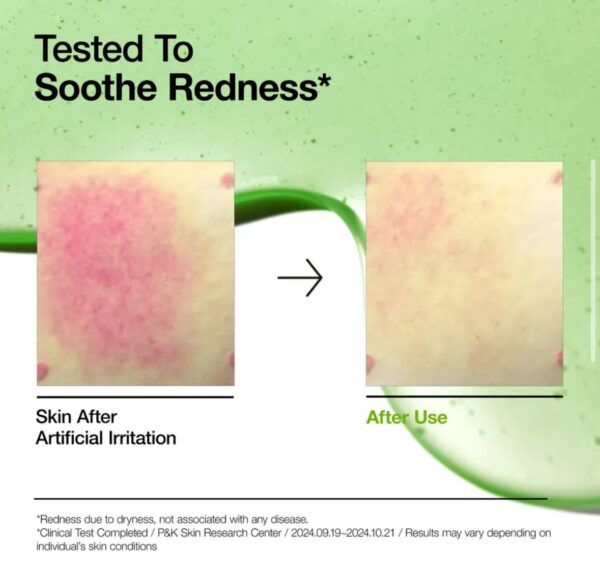Anua - Ácido azelaico 10% x30ml - Imagen 5