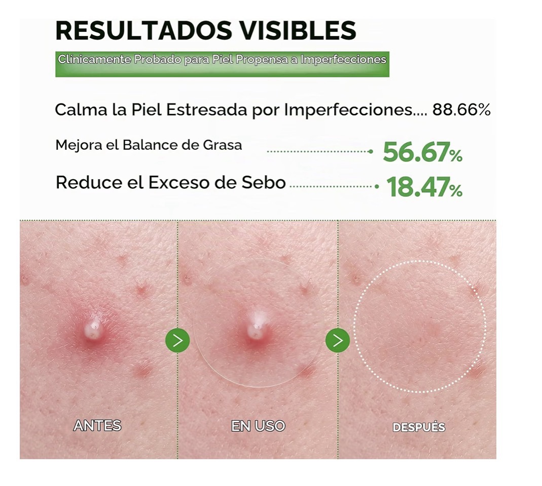 Dr.Melaxin - S-ZINC ZERO-FIT - Parche de manchas ultrafinas de 0.001 in con azufre, ácido salicílico, AHA y PHA, sin costuras, para debajo del maquillaje, parches de 0.472 in x 72 - Imagen 4