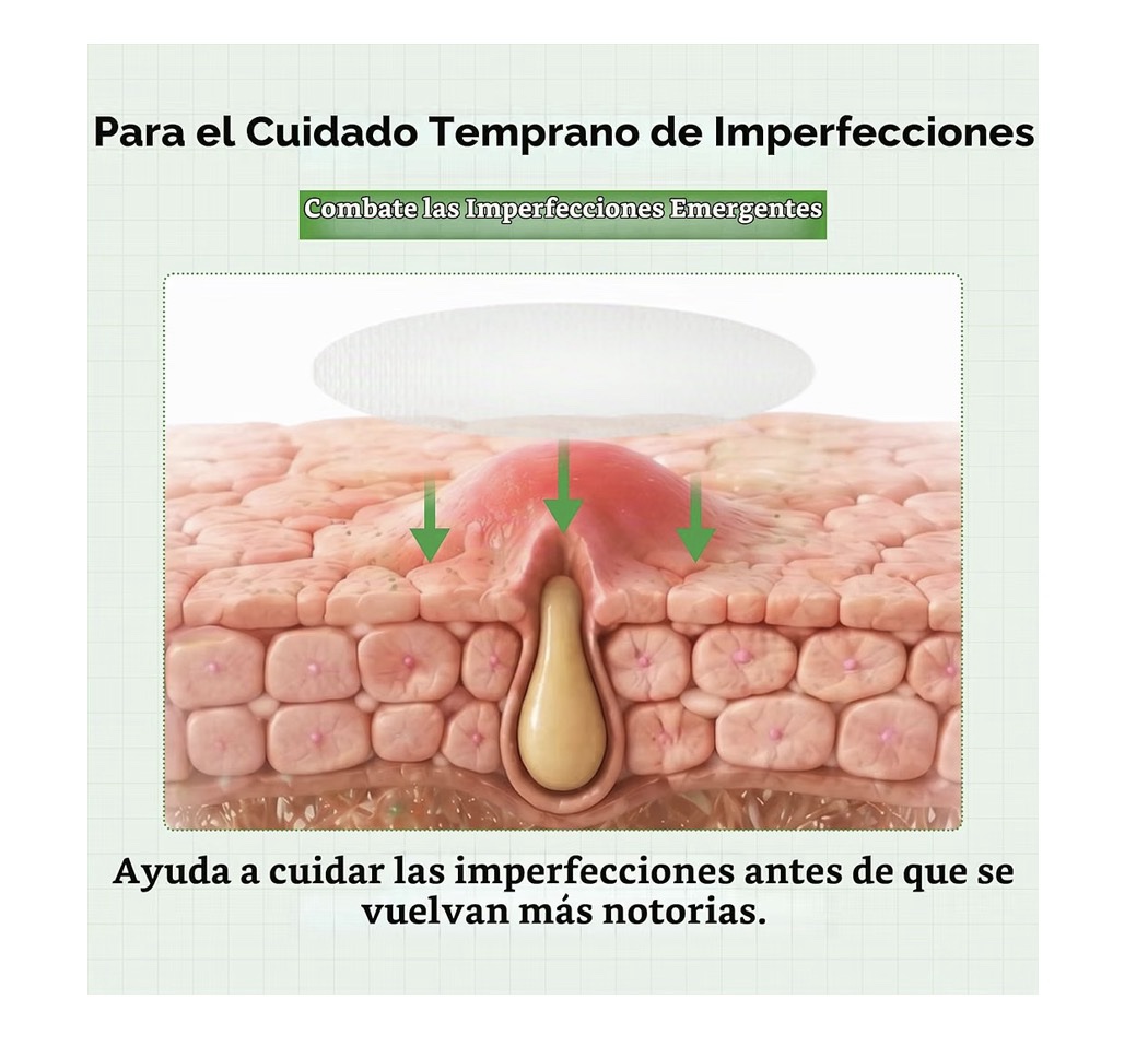 Dr.Melaxin - S-ZINC ZERO-FIT - Parche de manchas ultrafinas de 0.001 in con azufre, ácido salicílico, AHA y PHA, sin costuras, para debajo del maquillaje, parches de 0.472 in x 72 - Imagen 5