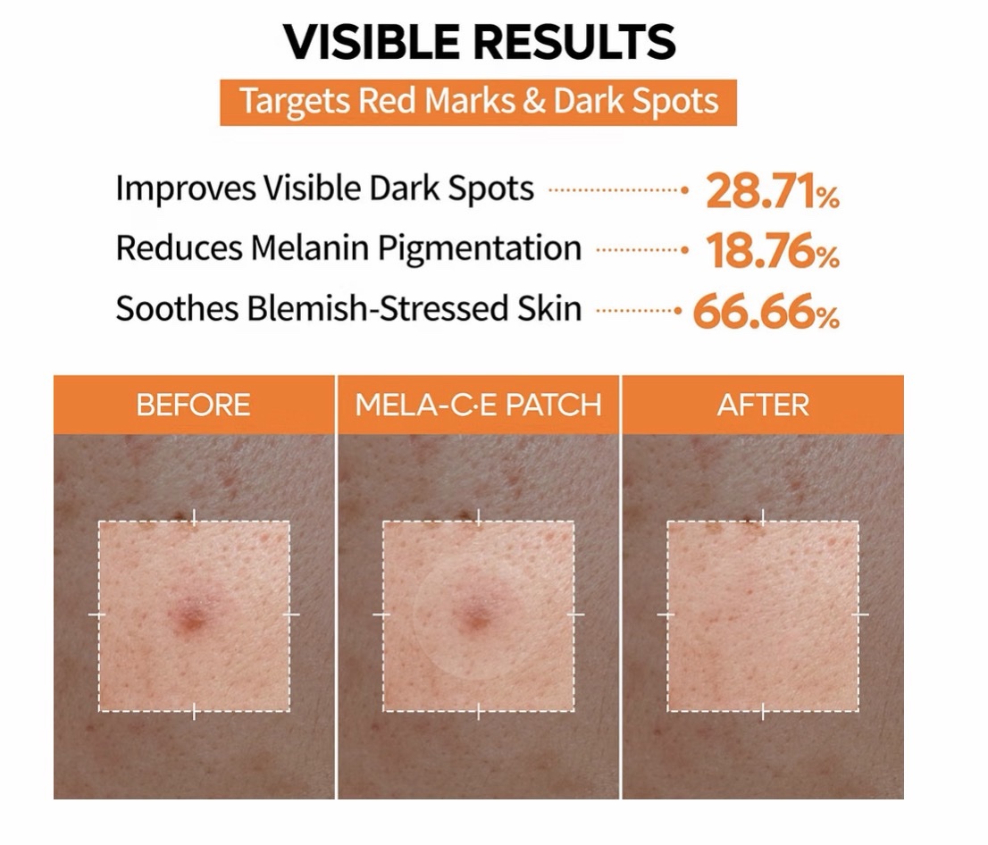 Dr.Melaxin - Mela-C·E ZERO-FIT - Parche ultra fino de 0.001 in, adhesivos invisibles para la cara con vitamina C, E y ácido ferúlico, sin costuras, para el cuidado del tono de la piel, 0.472 in x 72 - Imagen 4